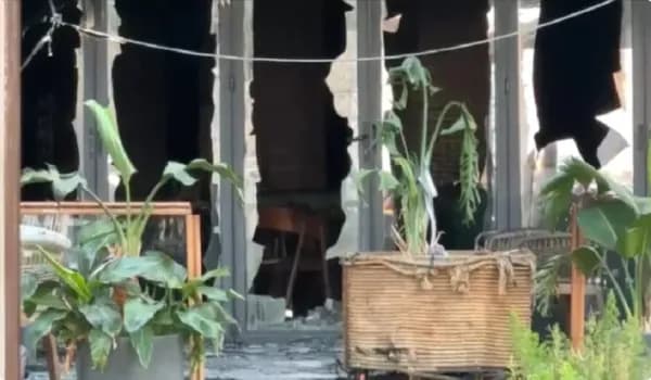 U dogj nga zjarri në një hotel në Vlorë, 25-vjeçarja dërgohet për trajtim në Turqi