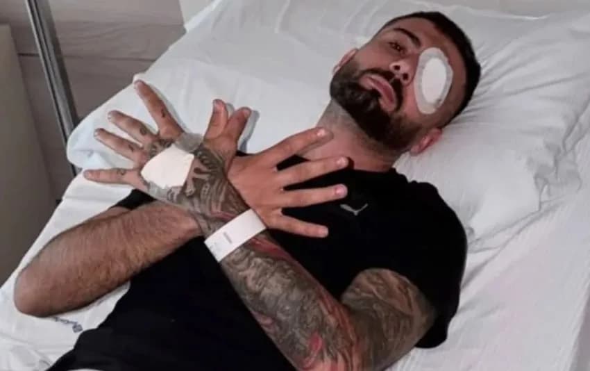 U plagos në sy gjatë protestës, reagon Erjon Vishkulli para operacionit në Itali: Zoti do të krijojë lehtësim pas vështirësive