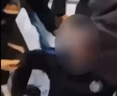 Protestuesi i plagosur në sy gjatë protestës në Tiranë, jashtë rrezikut për jetë