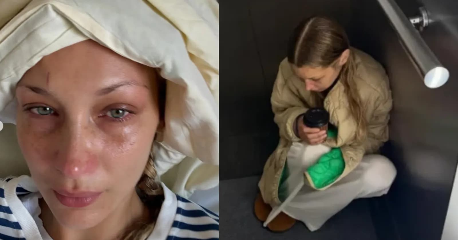 Super modelja botërore ndan foto tronditëse nga spitali – kjo është sëmundja nga e cila po vuan