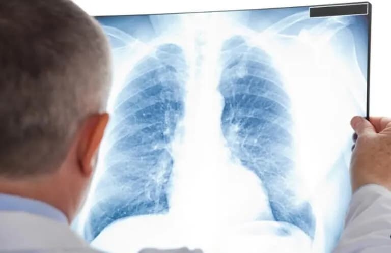 Tuberkulozi mbetet sfidë, vetëm vitin që shkoi u regjistruan 548 raste