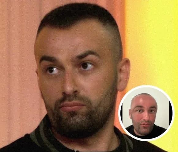 “Allah çka m’gjeti, mu ba kryt 10 killa”, Samedi flet për herë të parë si ia deformoi fytyrën botoksi