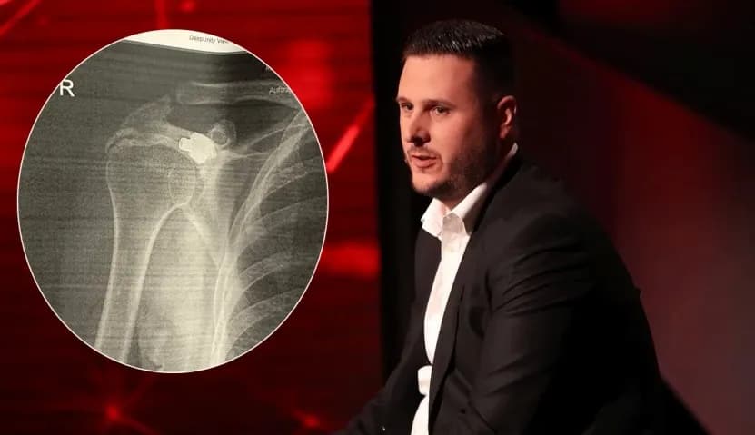 I gjendet plumbi në trup pas 27 vjetësh, rrëfimi i të mbijetuarit të familjes Berisha